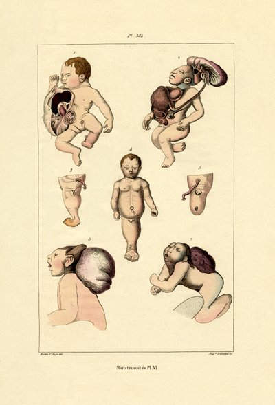 Freak von French School